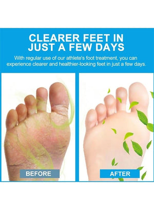 Sumifun - Foot Anti-Bacterial Cream UrShope